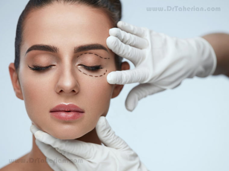 Eyelid surgery