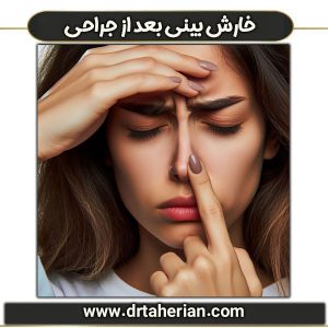 علت خارش بینی بعد از جراحی دکتر محمدحسین طاهریان ، جراح بینی طاهریان